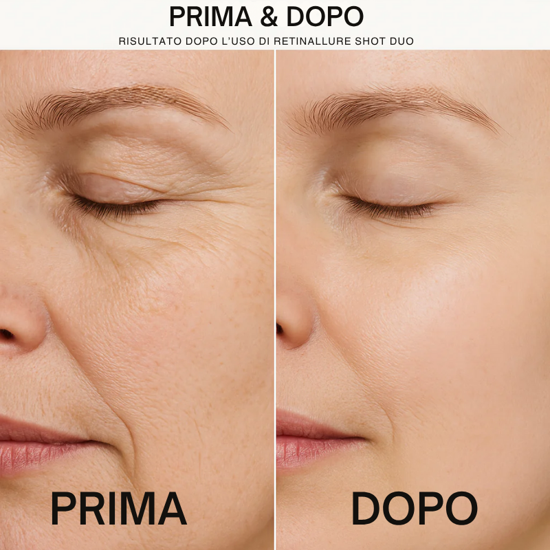 RetinAllure™ Shot Tensore Booster