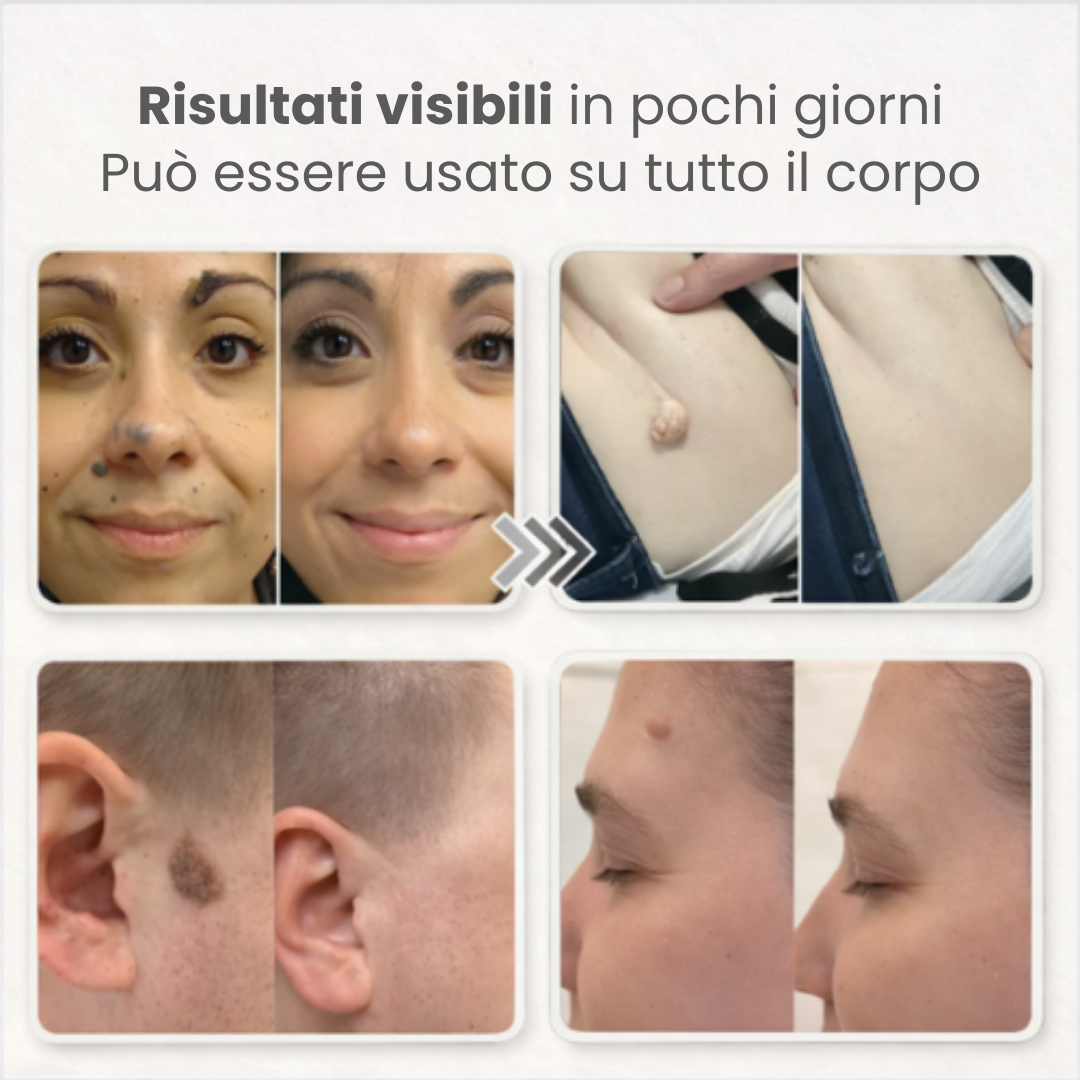Elovya - Patch per Imperfezioni Cutanee