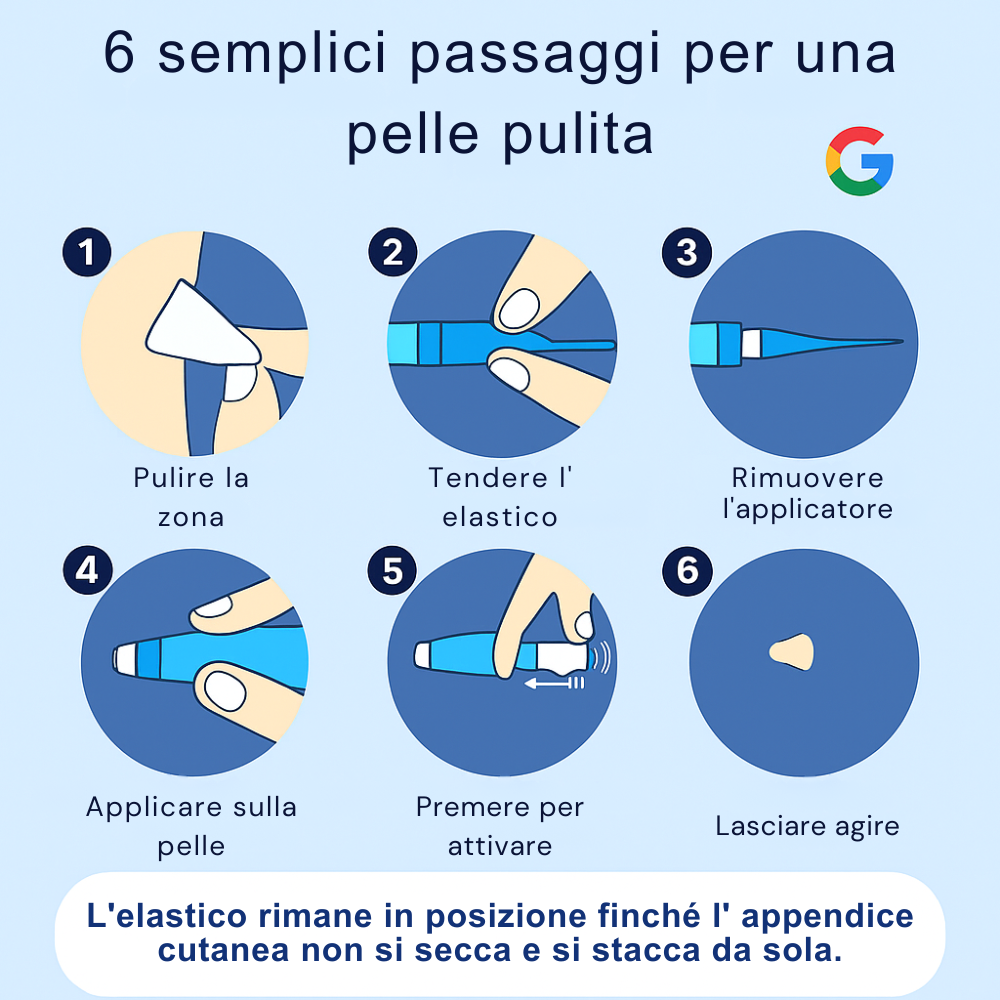 Set completo ALCURA™ - Mai più appendici cutanee