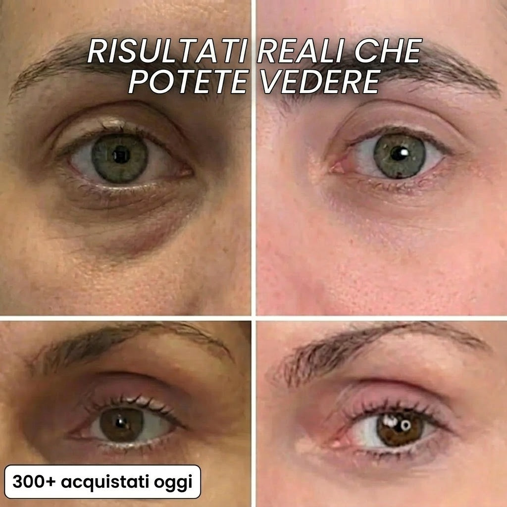 Stick rimpolpante al bio-collagene PDRN