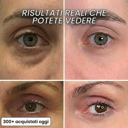 Stick rimpolpante al bio-collagene PDRN