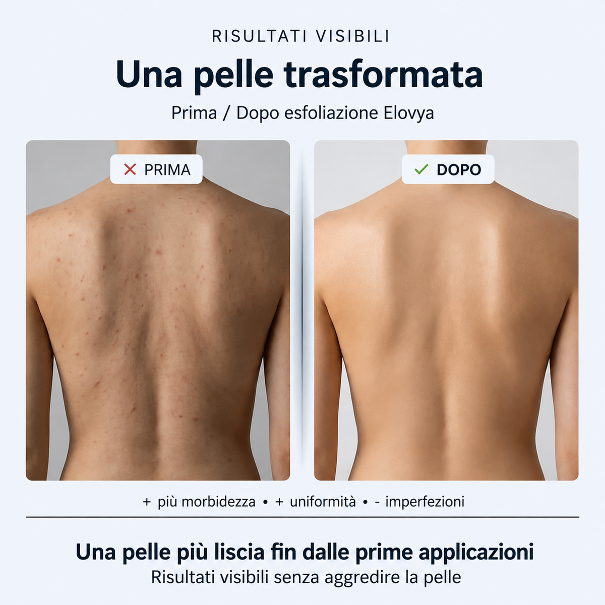 Asciugamano esfoliante Elovya per la doccia