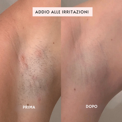 SILKLY™ - Tagliapeli Elettrico Femminile