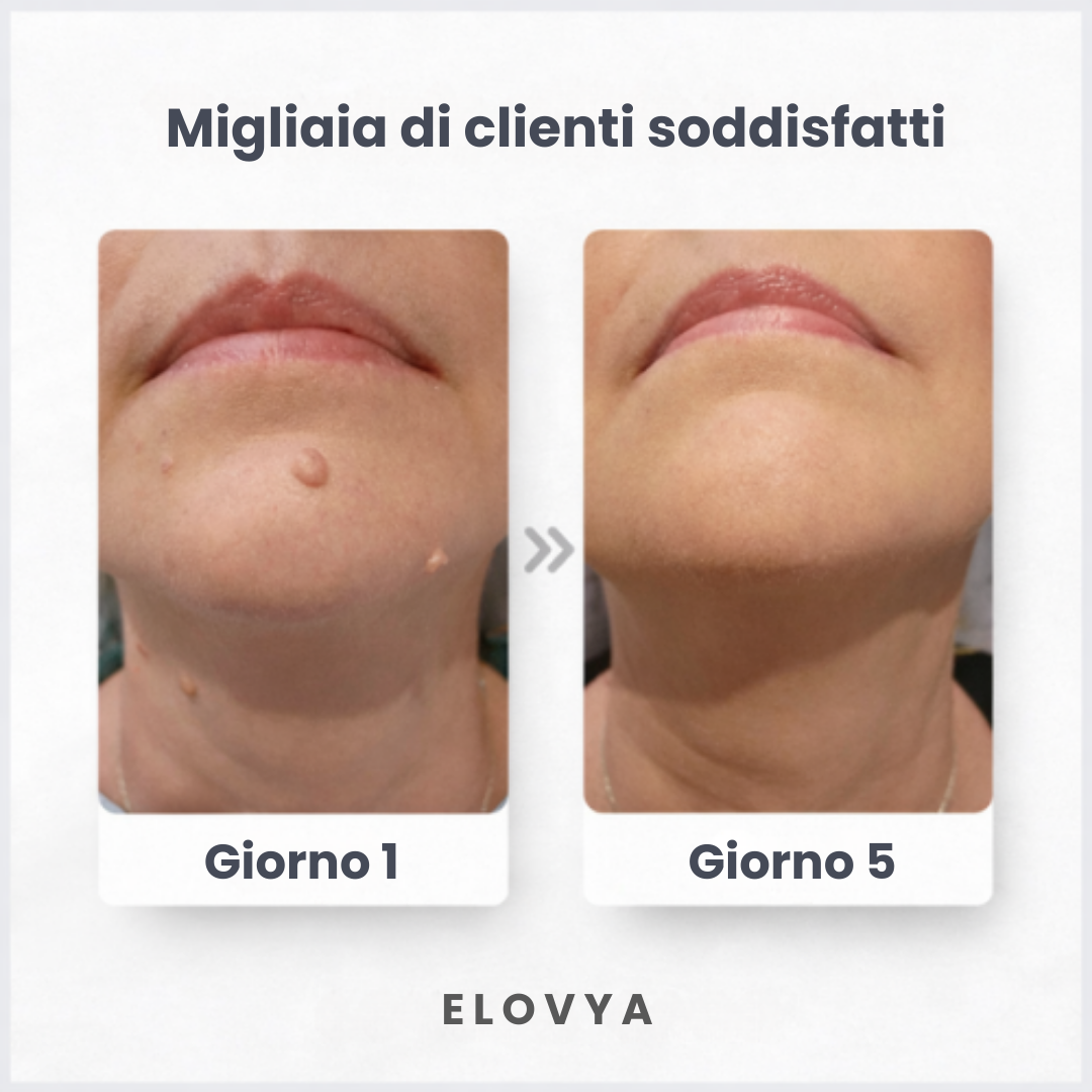 Elovya - Patch per Imperfezioni Cutanee