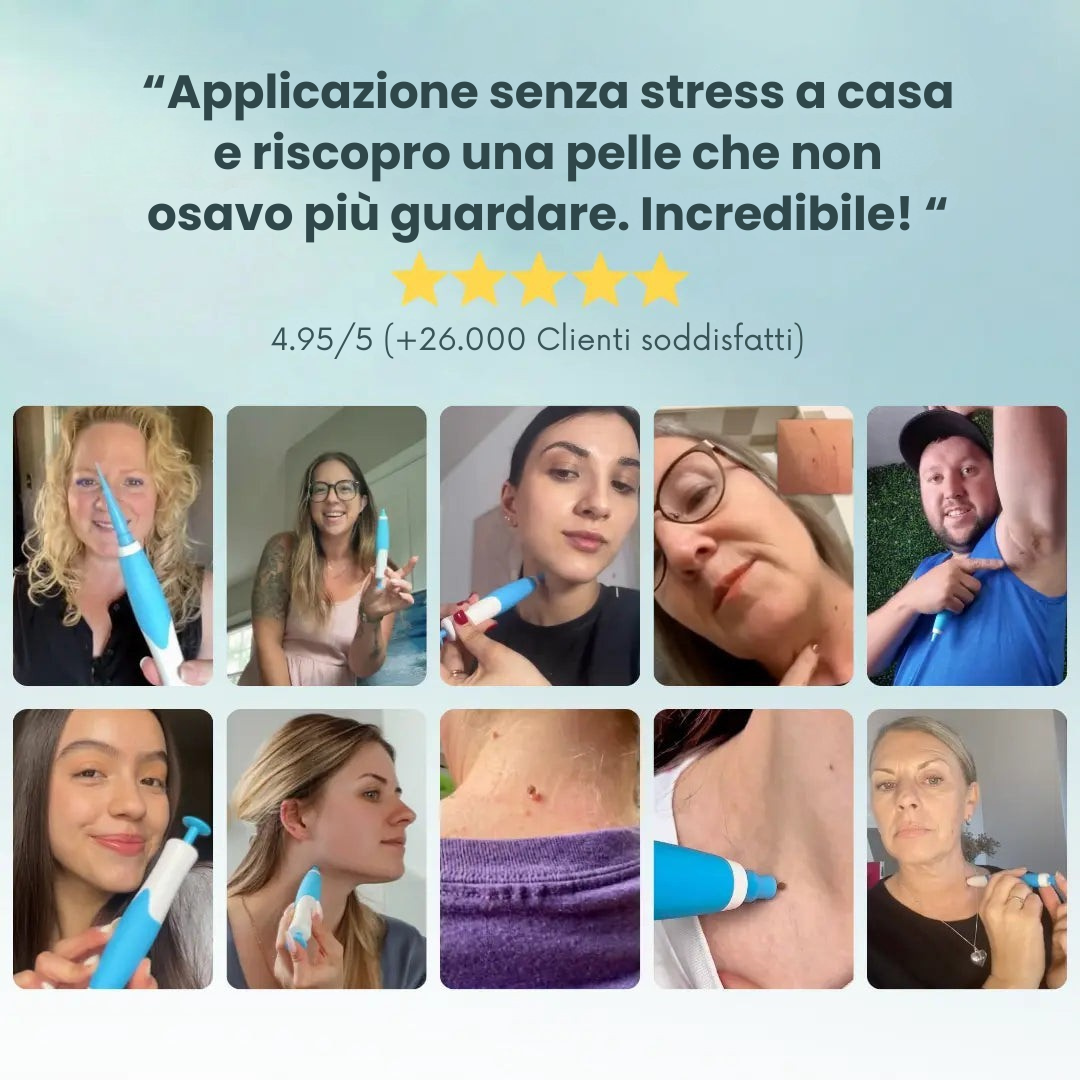 DermaSkin Pro - Addio ai porri della pelle