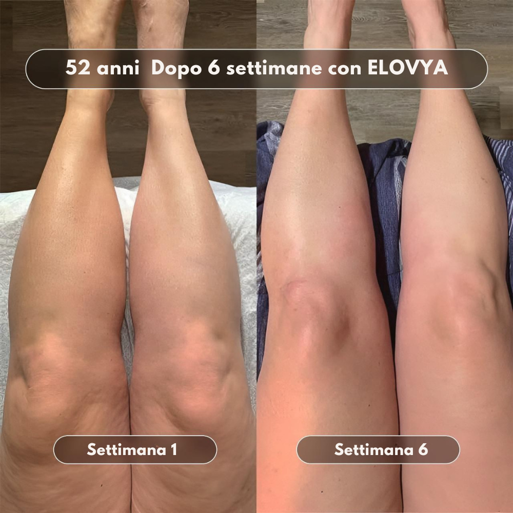 Olio da massaggio anticellulite