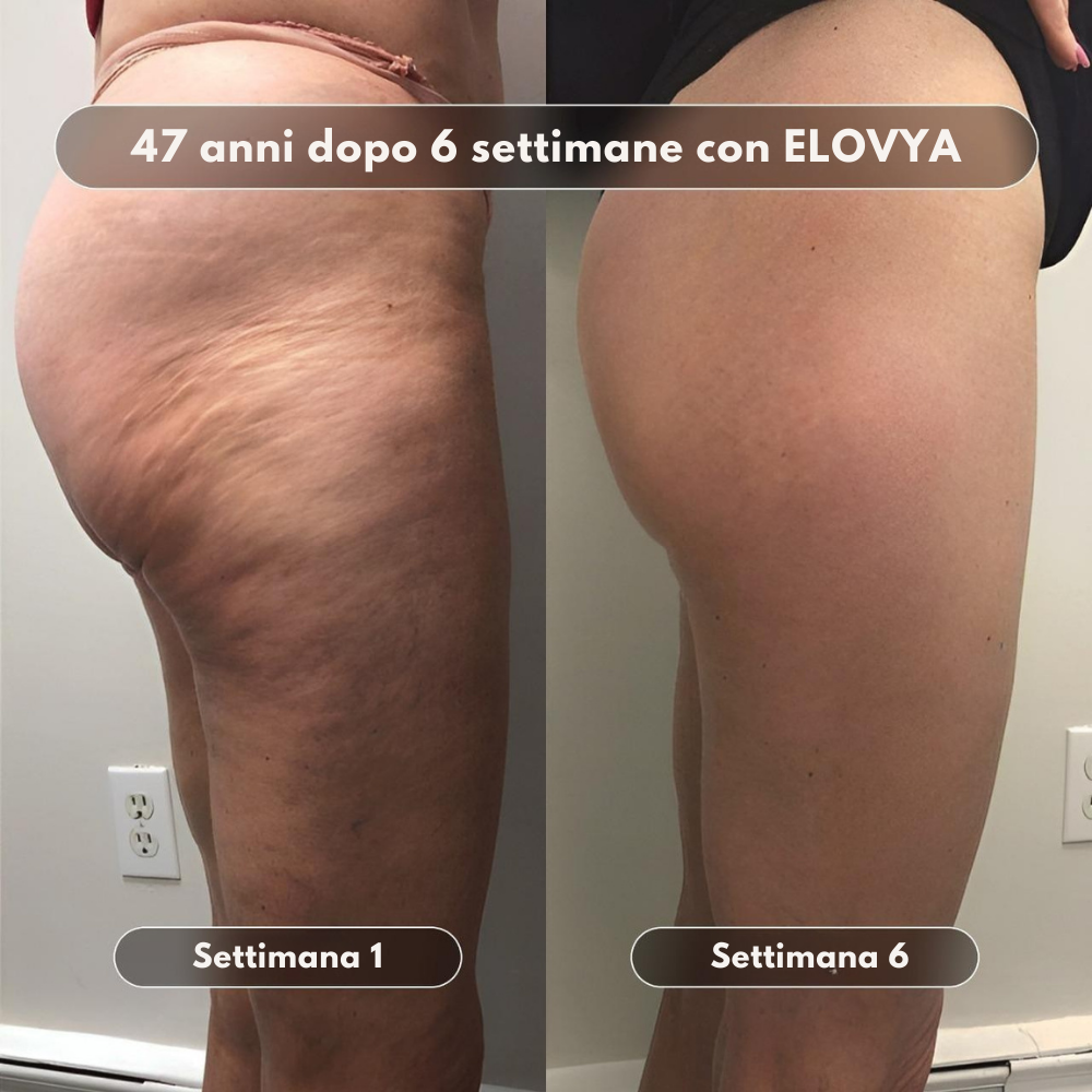 Olio da massaggio anticellulite