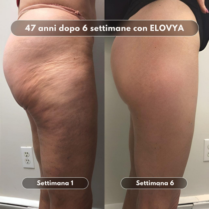 Olio da massaggio anticellulite