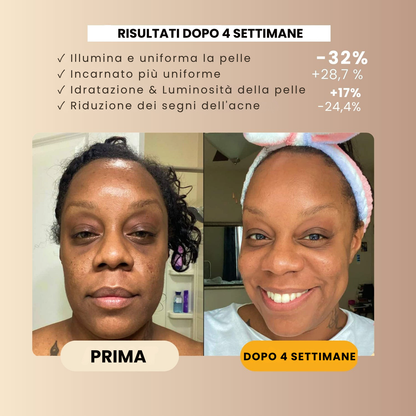 Sapone alla Curcuma Anti-Macchie
