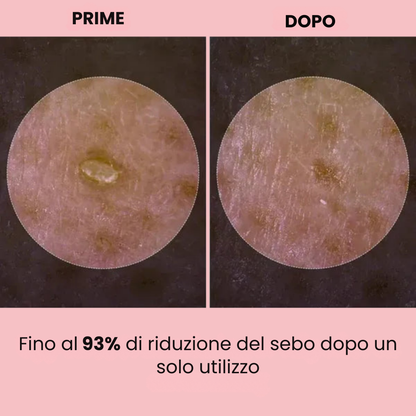 Pelle più chiara senza pori visibili
