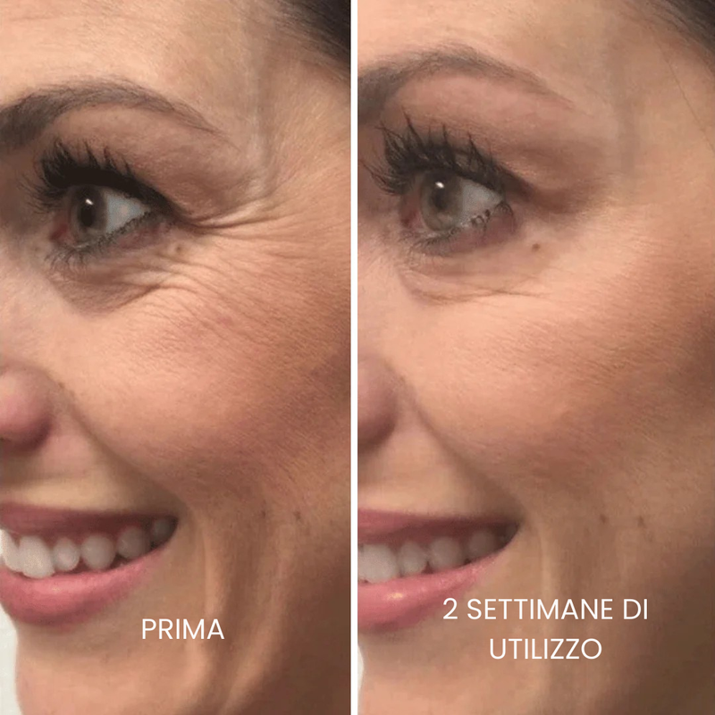 Risultati ultra rapidi !
