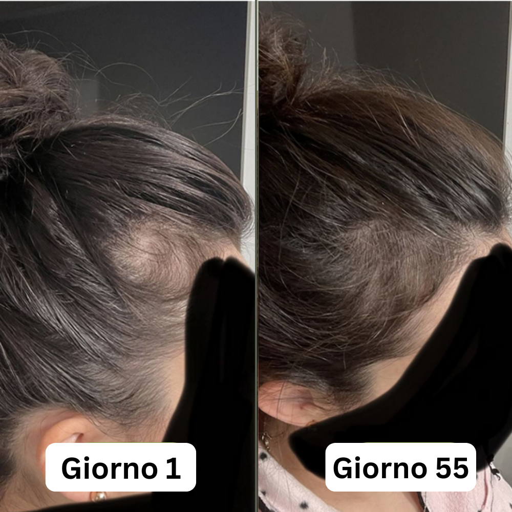 Siero per la crescita dei capelli (60 ml)