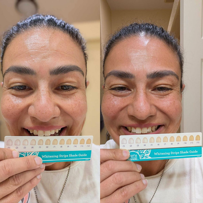 Strisce Sbiancanti Naturali Elovya – All’Olio di Cocco, Senza Dolore, Risultati in 7 Giorni