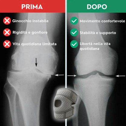 OrthoKnee Pro™ – Per una vita quotidiana senza dolori alle ginocchia