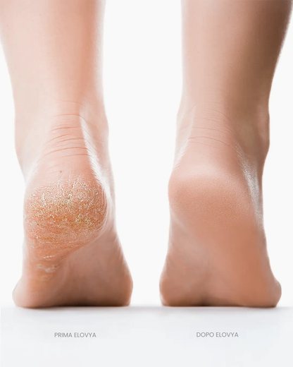 Elovya Silk 3 Pro - Raspa Elettrica Professionale
