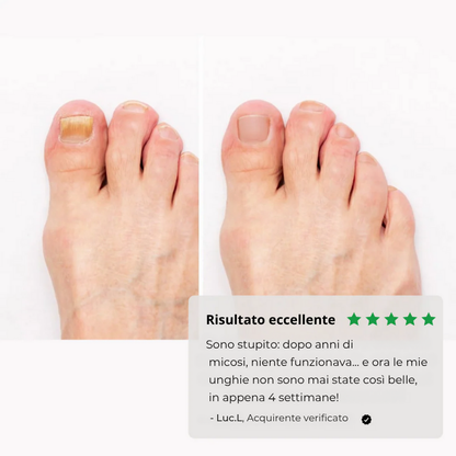 RinovaNail™ - Unghie sane, giorno dopo giorno