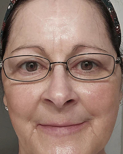 Dopo - Sofia, 38 anni
