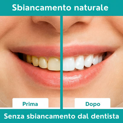 Strisce Sbiancanti Naturali Elovya – All’Olio di Cocco, Senza Dolore, Risultati in 7 Giorni