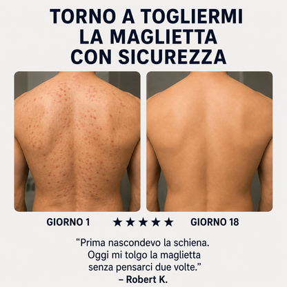 Sapone Zanari per la schiena contro l’acne