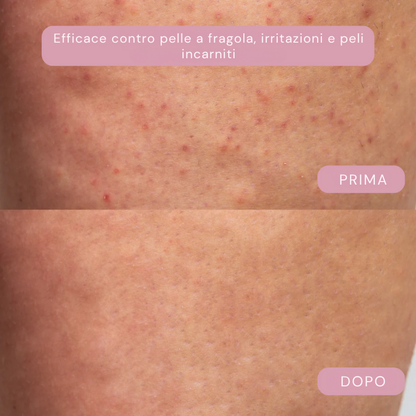 SetaLuce™ - La pelle liscia che illumina ogni giorno