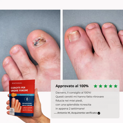 RinovaNail™ - Unghie sane, giorno dopo giorno