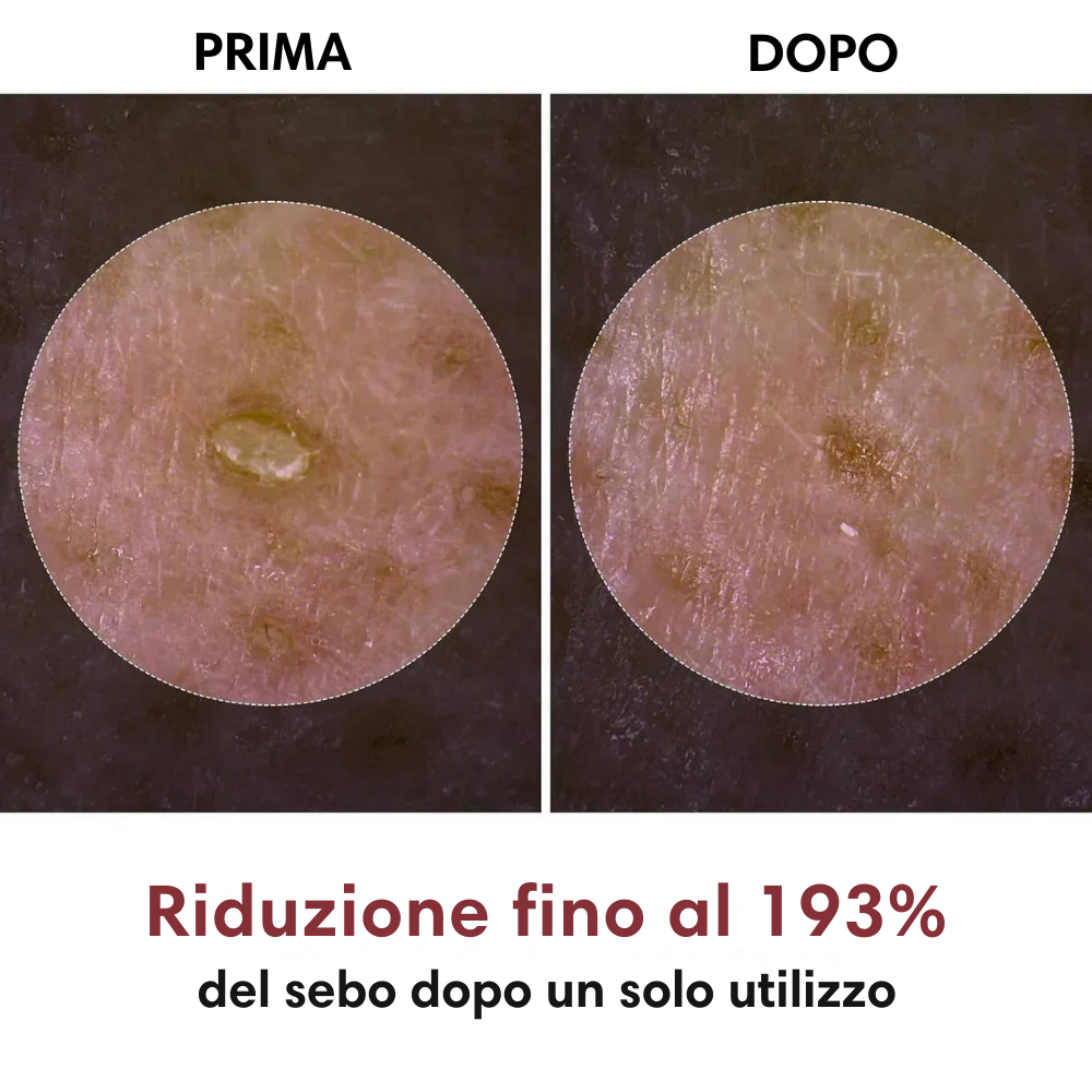 Fiala Esfoliante al Riso™