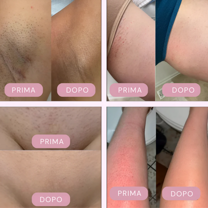 SetaLuce™ - La pelle liscia che illumina ogni giorno