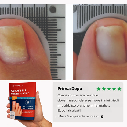 RinovaNail™ - Unghie sane, giorno dopo giorno