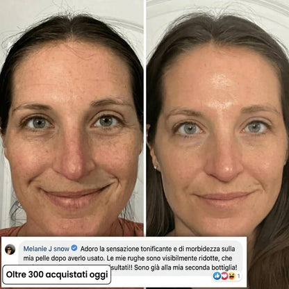 Stick rimpolpante al bio-collagene PDRN