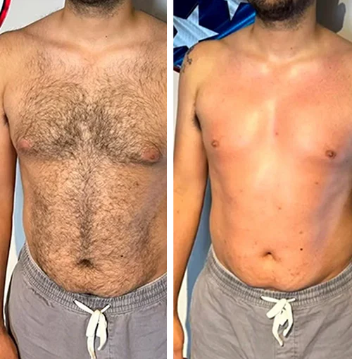 Arman T., 44