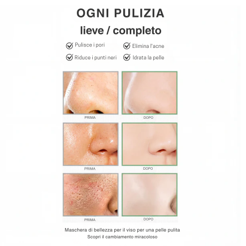 Stick Detox - Visibile contro Imperfezioni e Pori