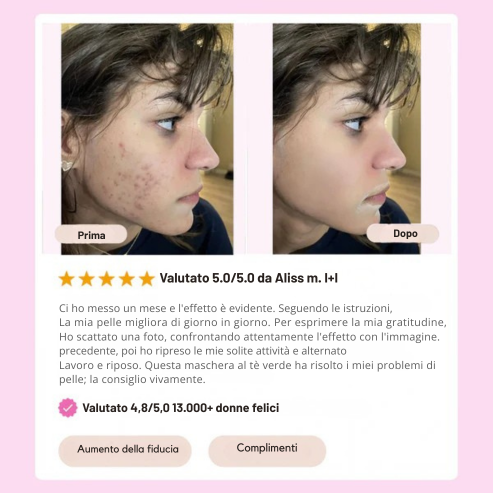 Stick Detox - Visibile contro Imperfezioni e Pori