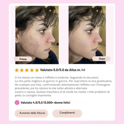 Stick Detox - Visibile contro Imperfezioni e Pori