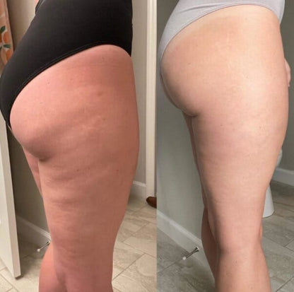 Olio da massaggio anticellulite