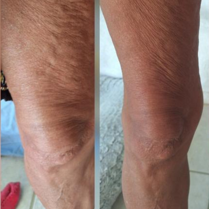 Olio da massaggio anticellulite