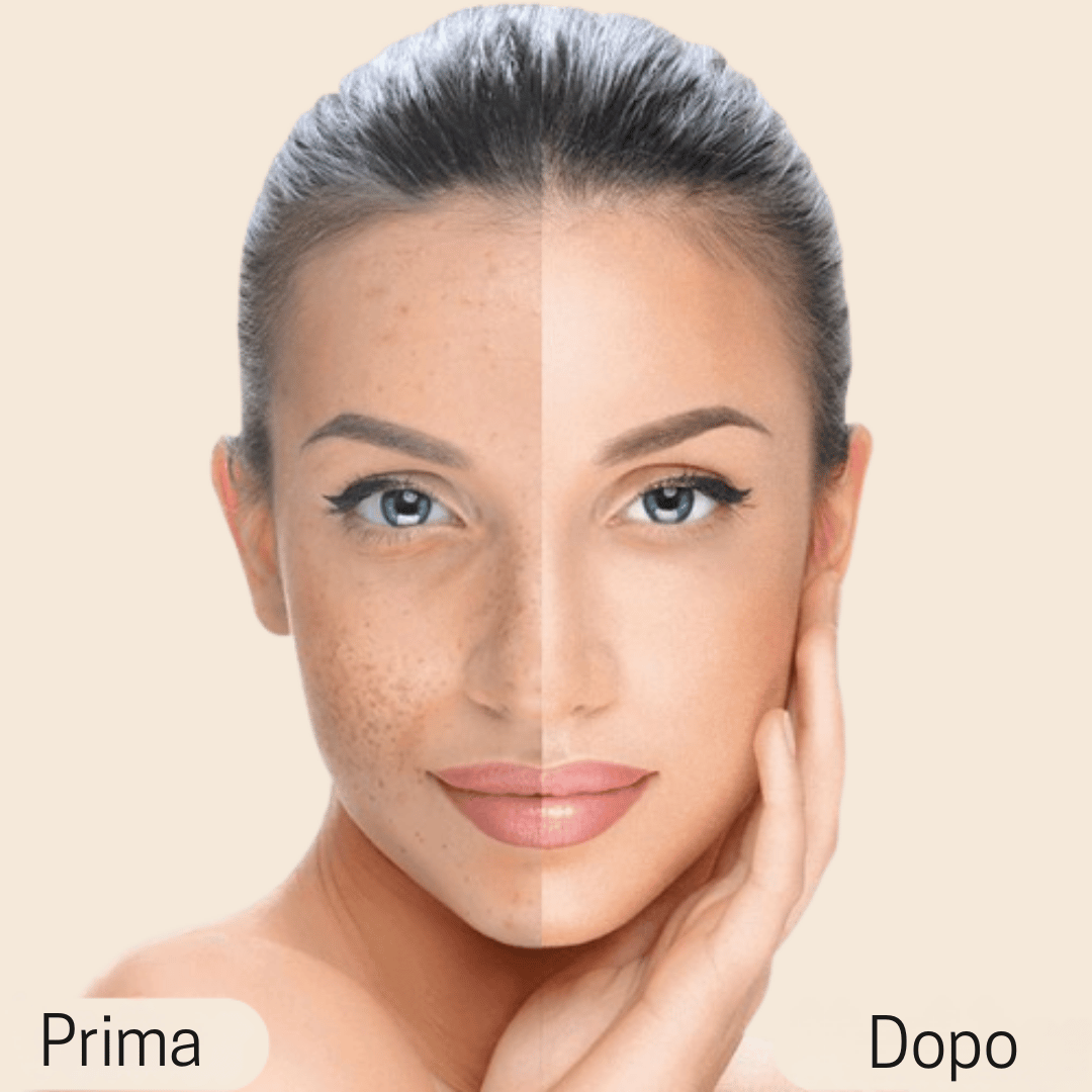 Elovya Perfect Cover Concealer – con formula traspirante