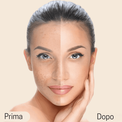 Elovya Perfect Cover Concealer – con formula traspirante