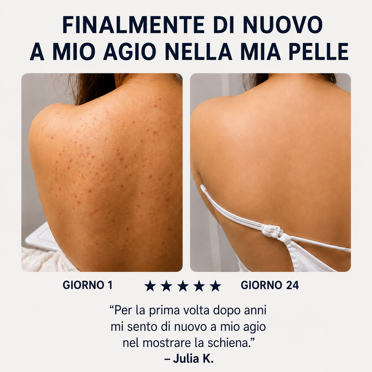 Sapone Zanari per la schiena contro l’acne