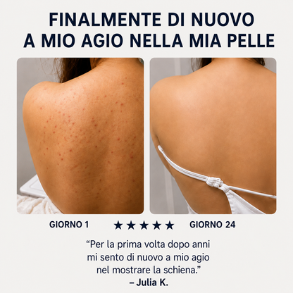 Sapone Zanari per la schiena contro l’acne