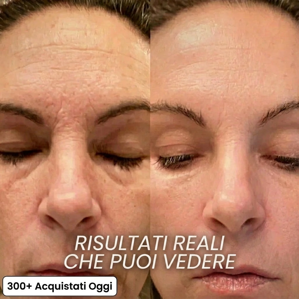 Stick rimpolpante al bio-collagene PDRN