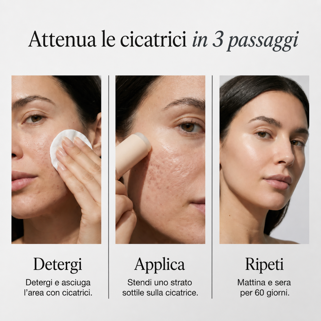 Stick™ per il trattamento clinico delle cicatrici da acne