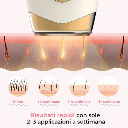 Fino al 93,6% di ricrescita in meno dalla 4ª settimana — clinicamente testato e di comprovata efficacia.
