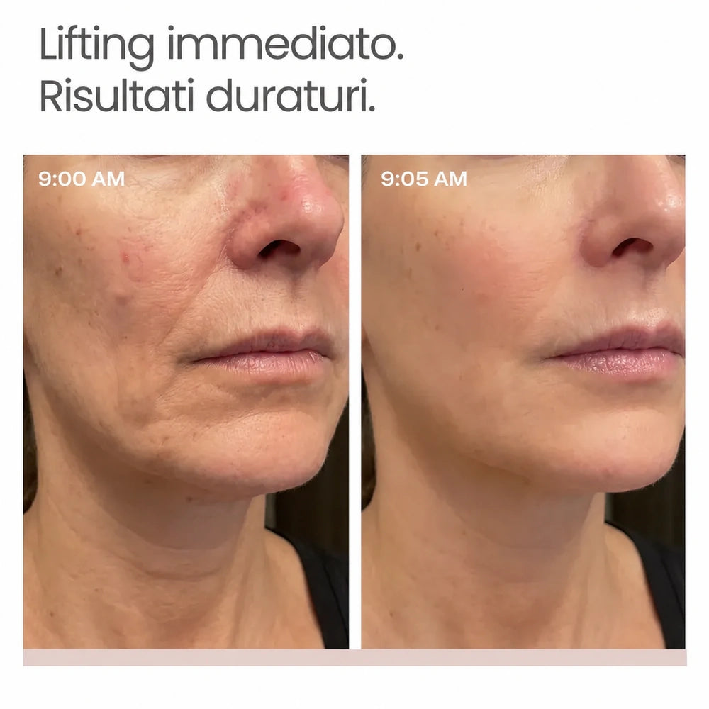 lifting istantaneo Elovya™