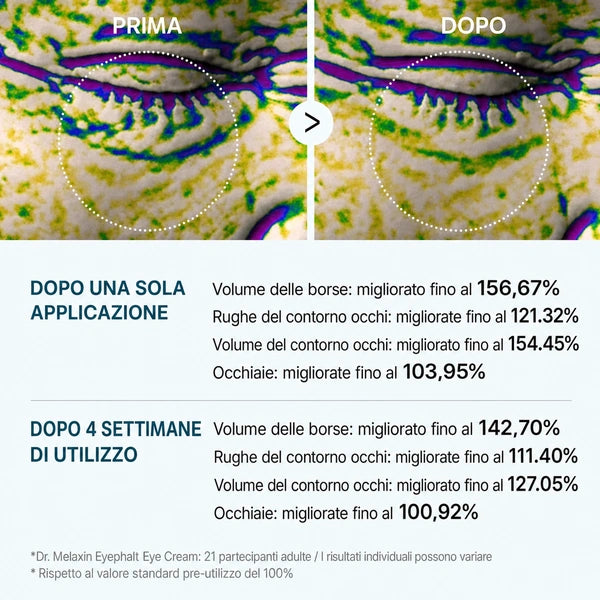 Elovya® contro le borse sotto gli occhi