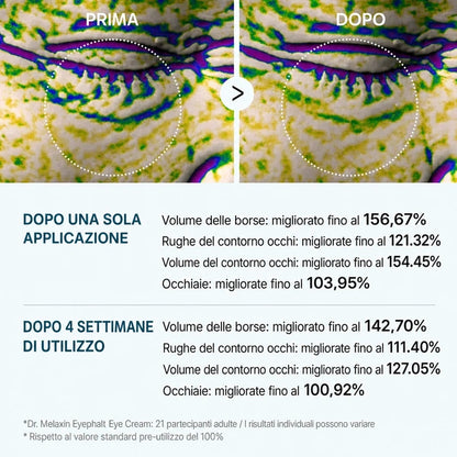Elovya® contro le borse sotto gli occhi