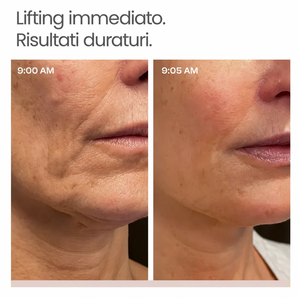 lifting istantaneo Elovya™
