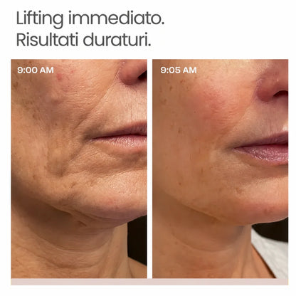 lifting istantaneo Elovya™