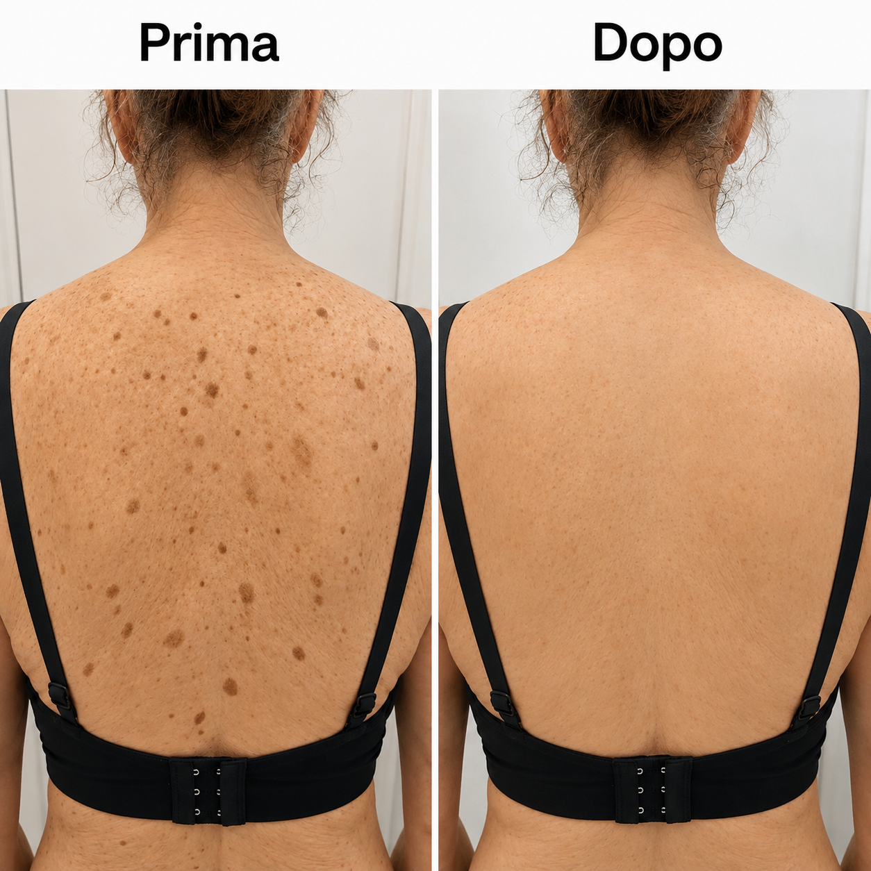 Elovya Stick corpo all’acido glicolico