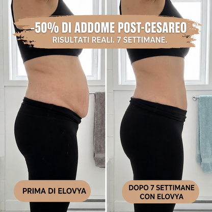 Culotte post-parto – Compressione a 360°