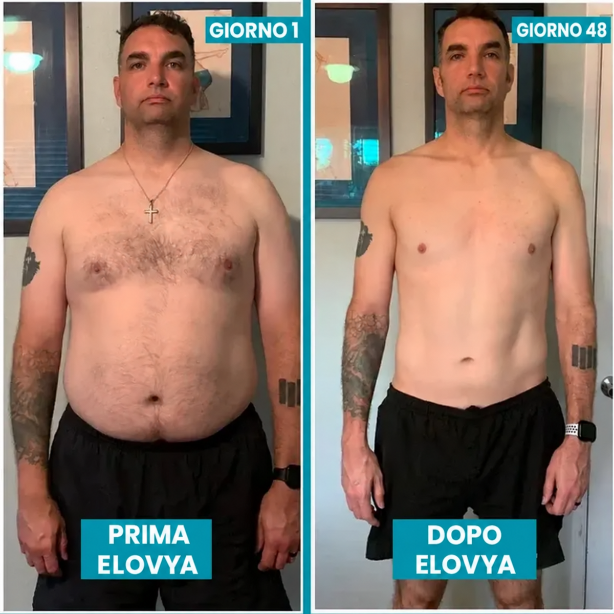 Elovya® 2.0 | Migliora la postura, modella l’addome e valorizza la tua silhouette.